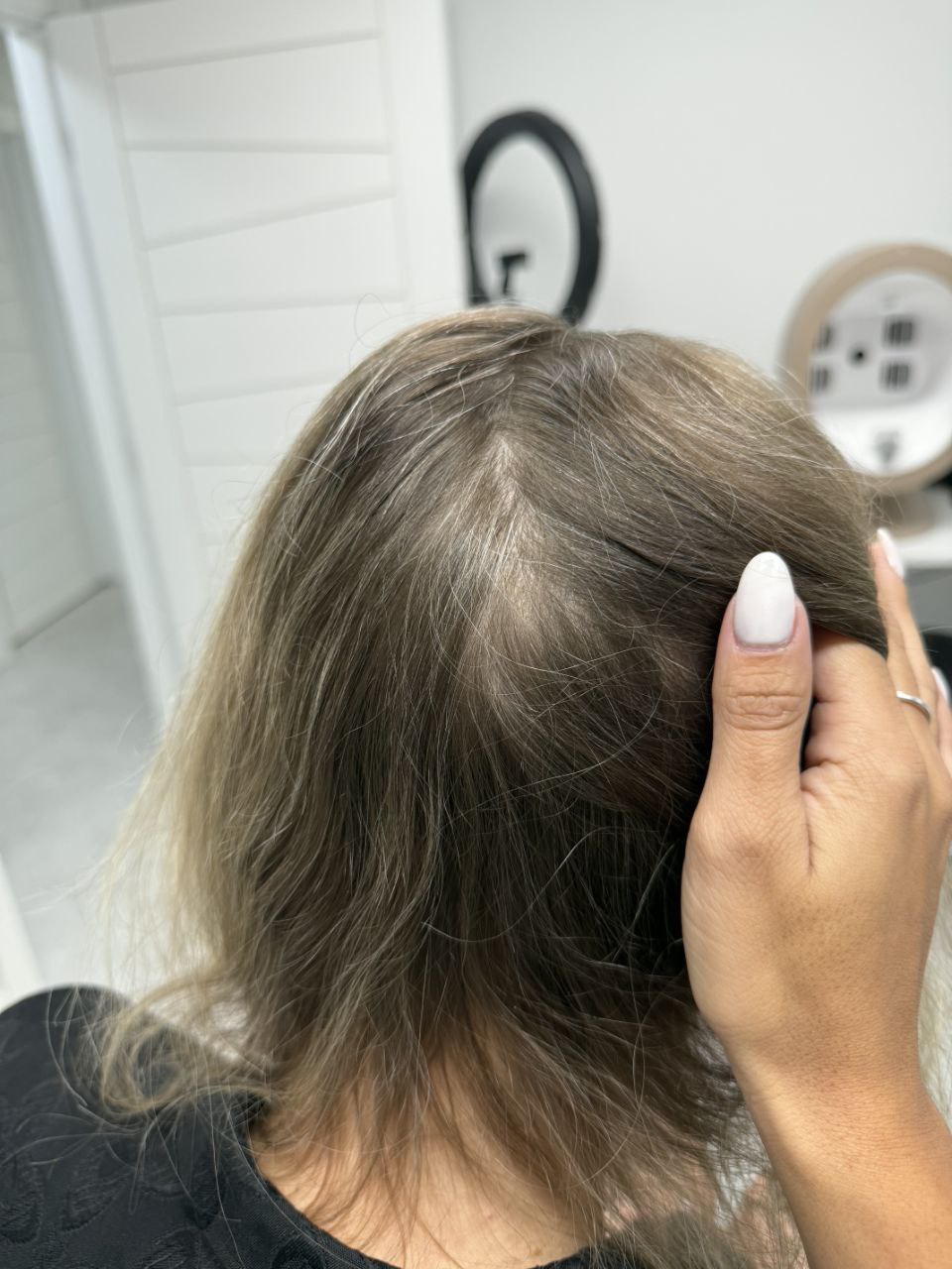 After treatment — thicker part line